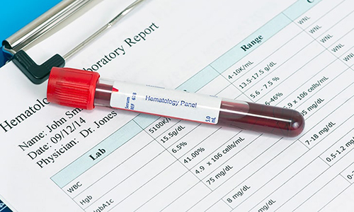 Kan Testindeki Değerlerin Anlamı